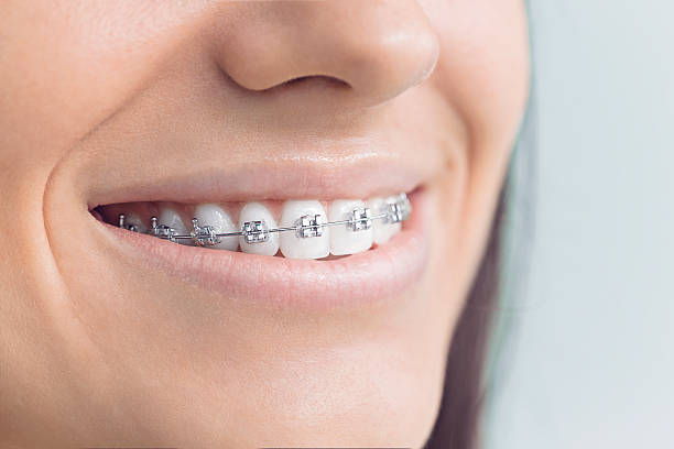 Best Dental Fillings (Composite and Amalgam)  in Toro Nyon, CA